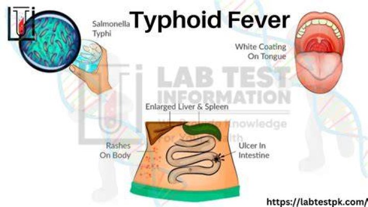 How is typhoid fever diagnosed?