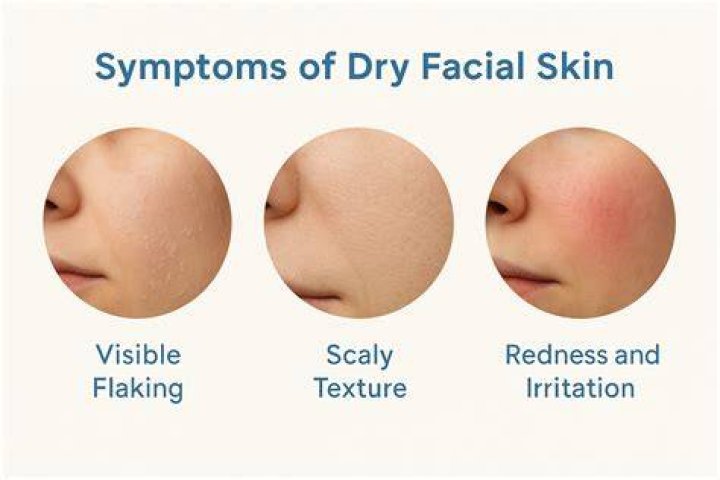 What causes dry flaky skin on face?