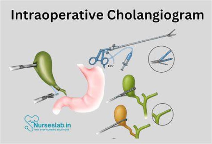 What is a Cholangiogram procedure?