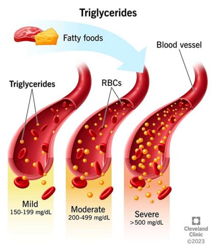 What is the main cause of high triglycerides?