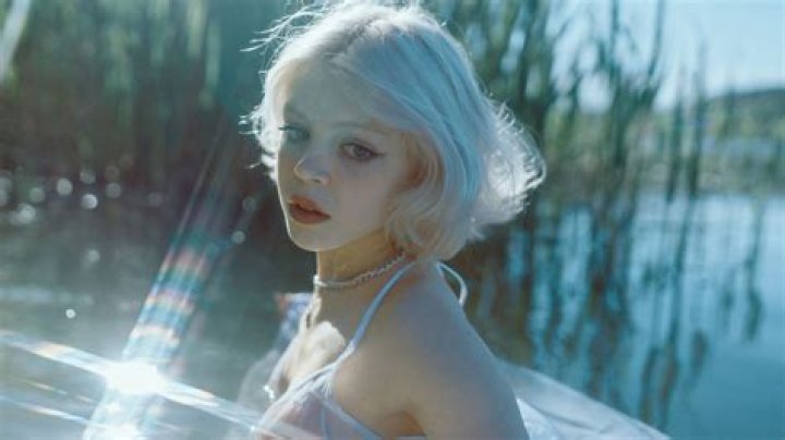 What is the reason for white hair in teenage?